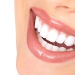 How Does a Cosmetic Dentist Perform Dental Veneers?