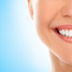 Teeth Whitening: Procedure, Advantages and Disadvantages 