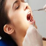 6 Helpful Tips If You Want to Prevent Dental Emergencies