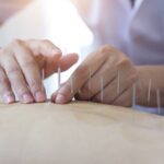 Is Acupuncture Effective?