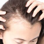 Understanding Hair Loss and Alopecia: Causes, Treatments, and Prevention with AZ Hair Restoration